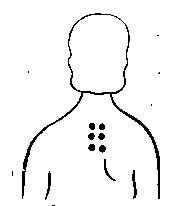 Точки  для надавливания при приступах астмы на спине